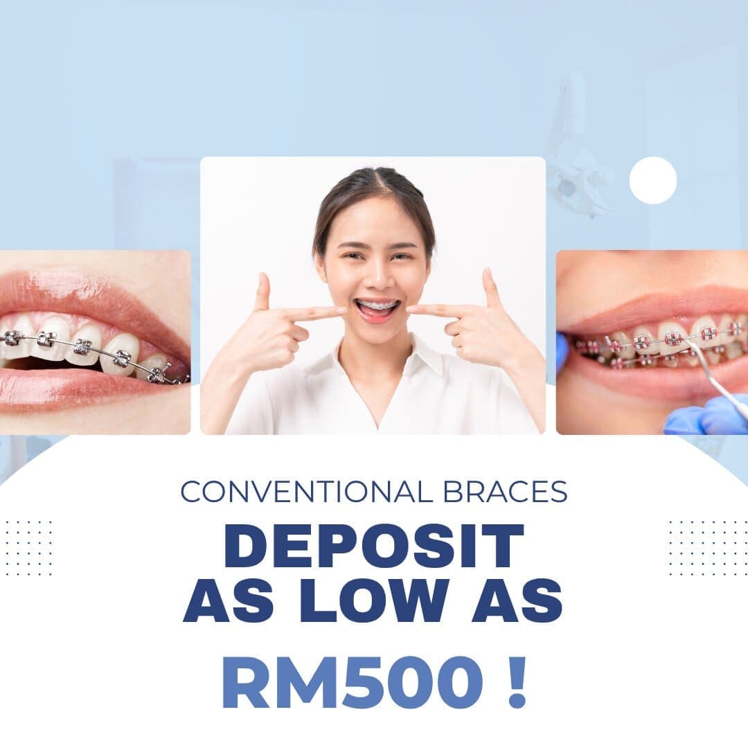 Dentalpark Kajang promotion 3