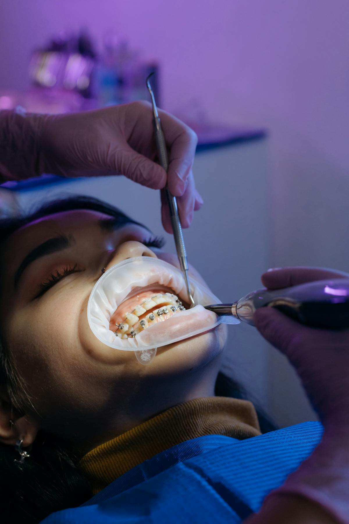 Braces / Clear Aligners