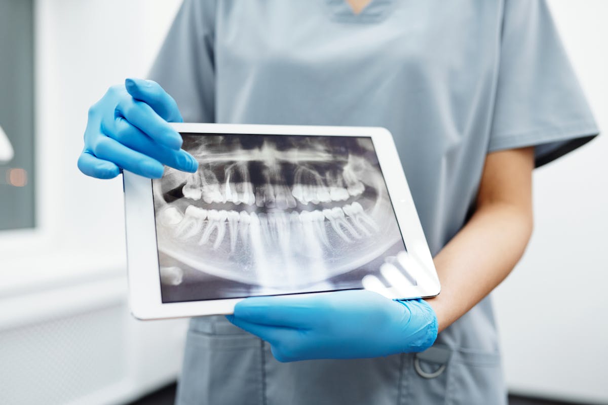 Root Canal